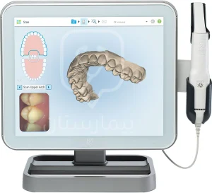 الطبعات الرقمية للأسنان تكون اكثر دقة